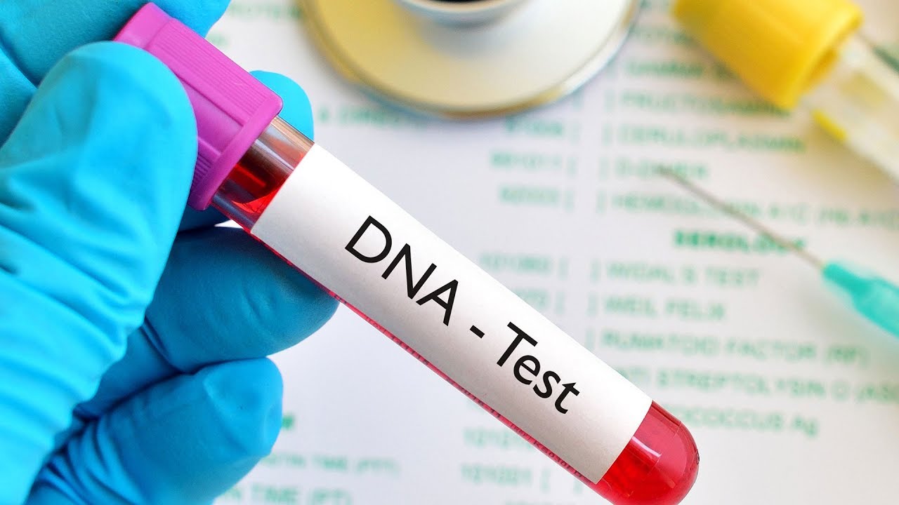 DNA-tests
