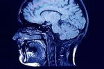 brain 50 plus