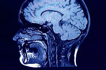 brain 50 plus